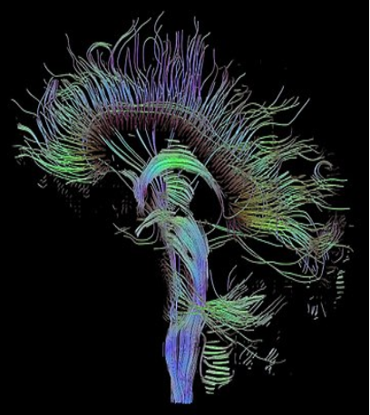  Hebbian learning is the strengthening of connections between postsynaptic and presynaptic neurons based on activity-dependent synaptic activity. Applying Hebbian theory to computational neuroscience allows us to envision the connections between various neurons in the brain, displayed here is what is called a 'connectome'.